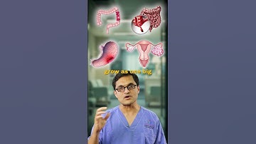 When Cancer Spreads Inside the Abdomen #peritonealcancer #cancer #cancerawareness #cancertreatment