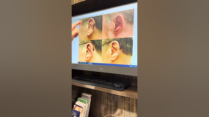 Plastic Surgeon Offers Ear Reconstruction for President Trump #drpaulvanek #donaldtrump