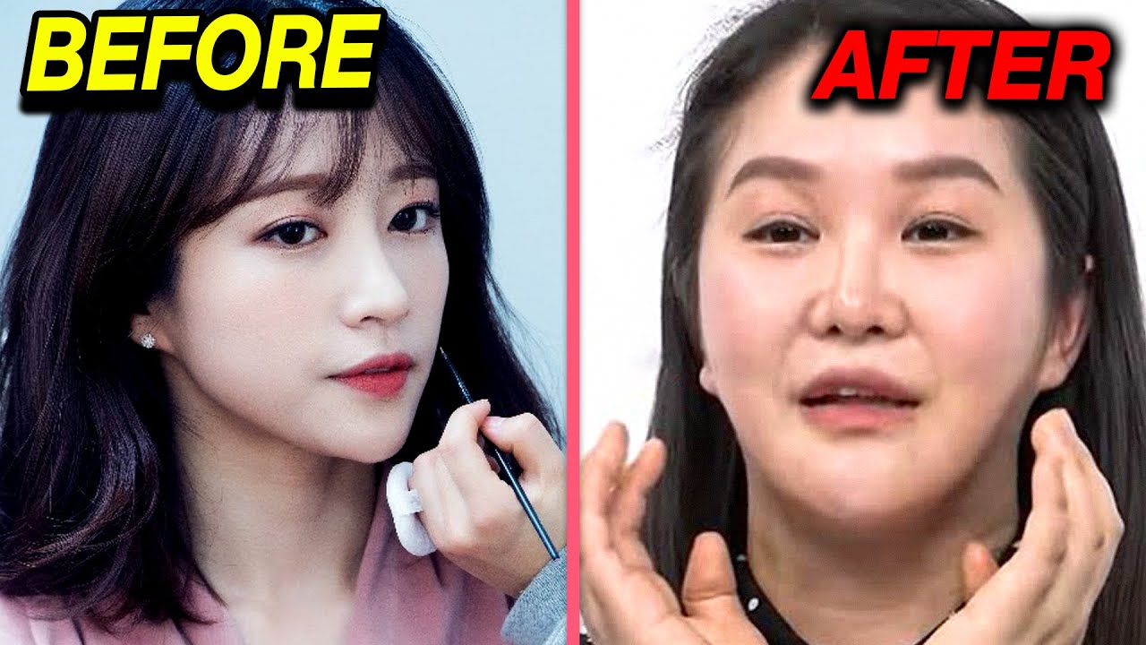Kpop Idols Who Destroyed Their Looks After Beauty Procedures - Youtube