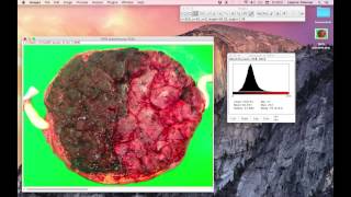How to measure the color difference ratio in TAPS placentas using ImageJ