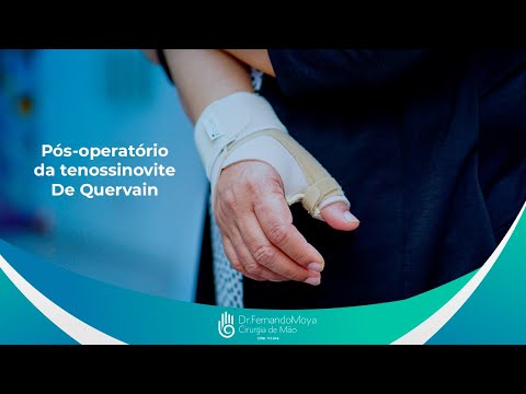 Pós-operatório da tenossinovite De Quervain | Dr. Fernando Moya CRM 112046