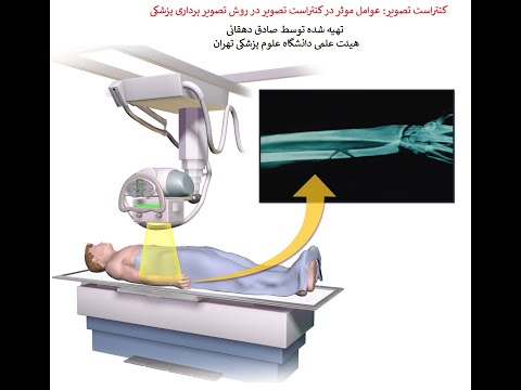 تصویری: کنتراست در اشعه ایکس چیست؟