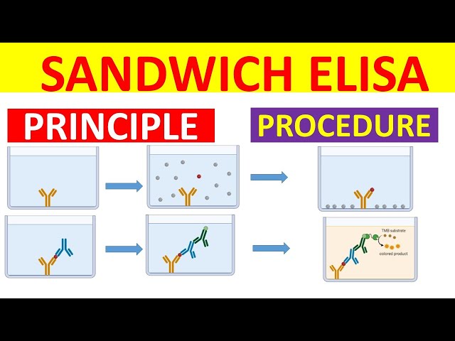 Sandwich Elisa