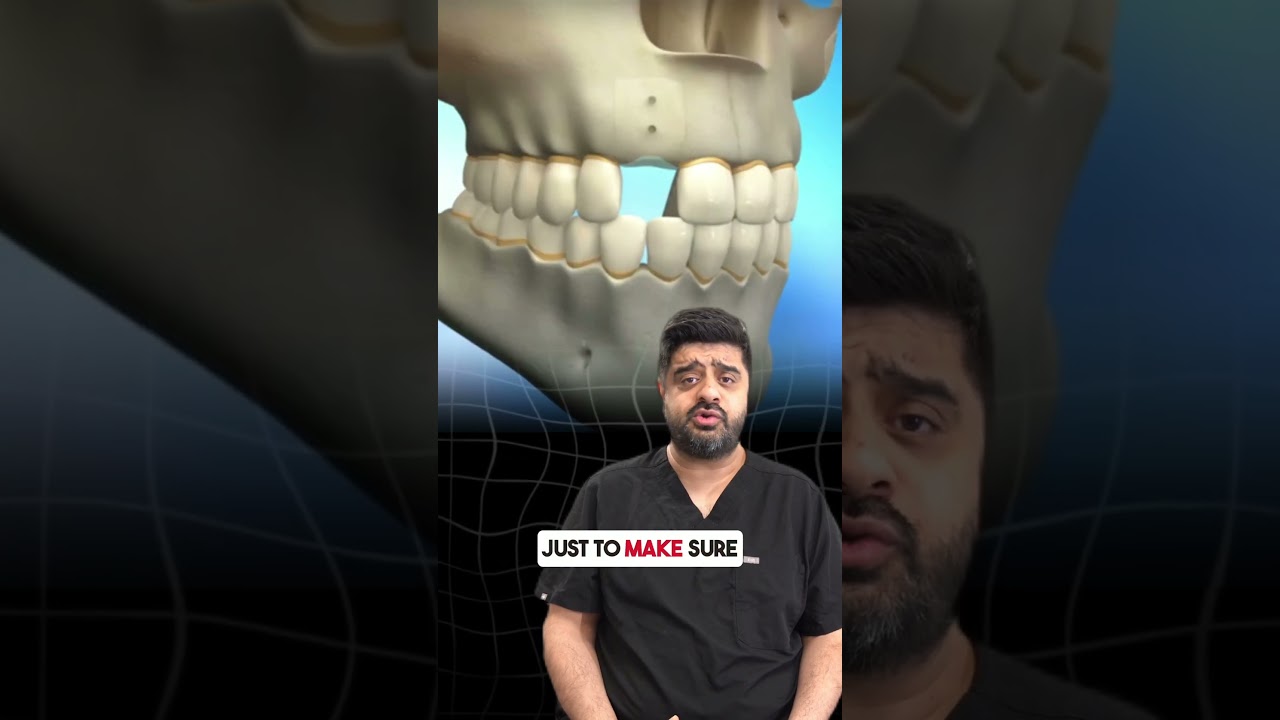 Told No Implant Due to Bone Loss | See How We Made It Possible