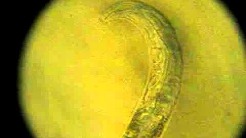 C. elegans pharyngeal pumping