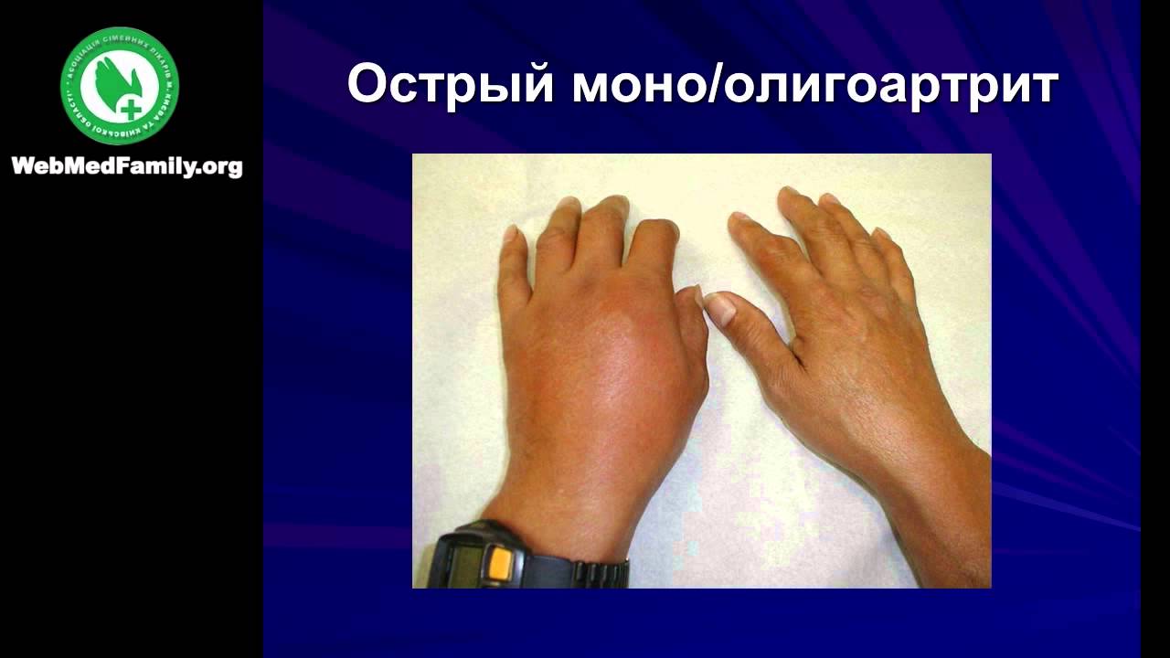 Николай Николаевич Руденко - YouTube