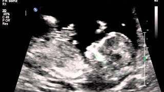 scan.avi