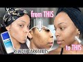 HOW TO: get rid of DARK SPOTS on your FACE & GET CLEAR SKIN | I used DIFFERIN Gel for a MONTH!