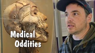 Creepy Medical Museum