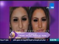 د. فادي مجدي يعقوب يتحدث عن عمليات التجميل على TEN TV