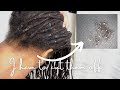 “I have to cut my locs off” | Buildup, Lint and How I Sadly got rid of it.