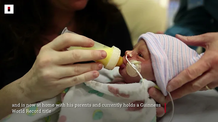 World's Most Premature Baby Celebrates First Birthday | IOL News