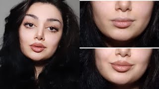 Dolgusuz Dudak Nasıl Büyütülür?