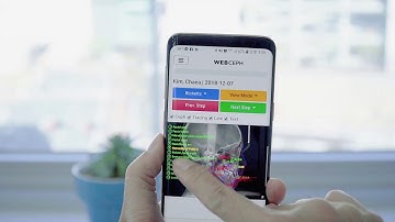 Mobile demo of WebCeph: A.I.(Artificial intelligence) Cephalometric Analysis Platform