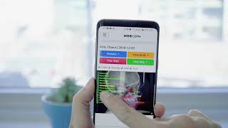 Mobile demo of WebCeph: A.I.(Artificial intelligence) Cephalometric Analysis Platform screenshot 5