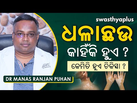 ଧଳାଛଉ କାହିଁକି ହୁଏ? କେମିତି କରିବେ ଚିକିତ୍ସା | Dr Manas Ranjan Puhan on Vitiligo in Odia | Treatment