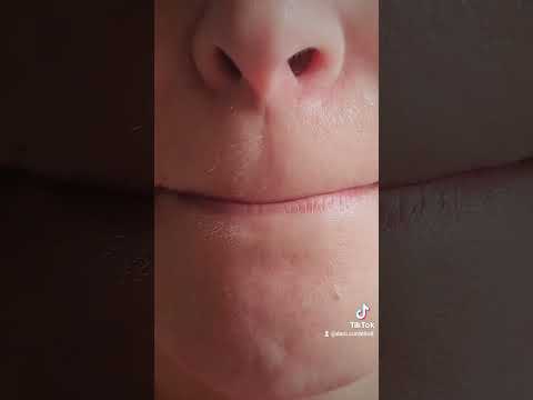 Spa nos lábios #spa #labios #skincare