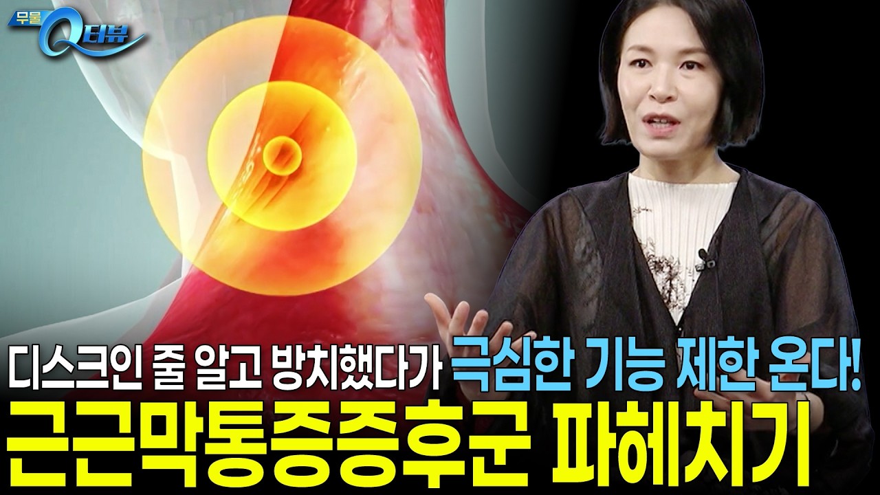 단순 근육통과 근근막통증증후군의 차이! 서울대병원 교수가 알려주는 정확한 진단과 치료법 I 🔍Q터뷰 문지연 교수 I KBS 무엇이든 물어보세요 20261008 방송