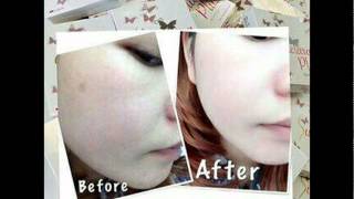 Jual Gluta Sunclara Asli, Gluta Sunclara Plus whitening Suplemen 085334588611