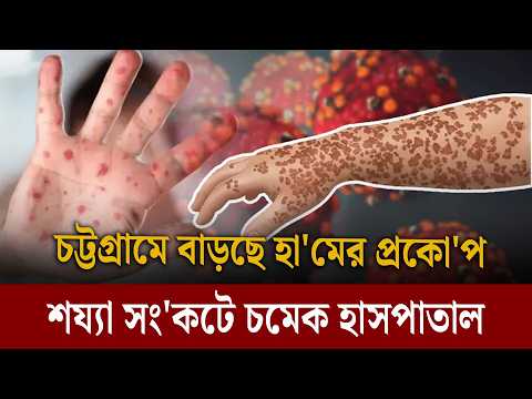 চট্টগ্রামে বাড়ছে হা'মের প্রকো'প, শয্যা সং'কটে চমেক হাসপাতাল | Dainik Purbokone । দৈনিক পূর্বকোণ