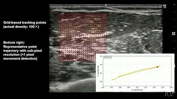 Fig.1: Ultra Dense Motion Tracking