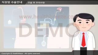 [For demonstration purposes] c0033aako Rectal cancer surgery guide: abdominoperineal resection
