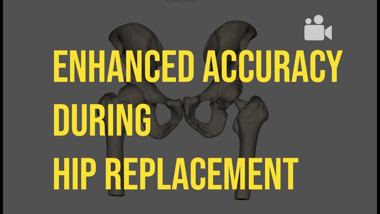 ACL Rupture - Dr. Chien-Wen Liew