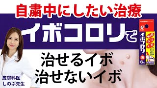 【自粛で病院に行けない！イボ治療】イボコロリを使えるイボと使えないイボについて解説します！