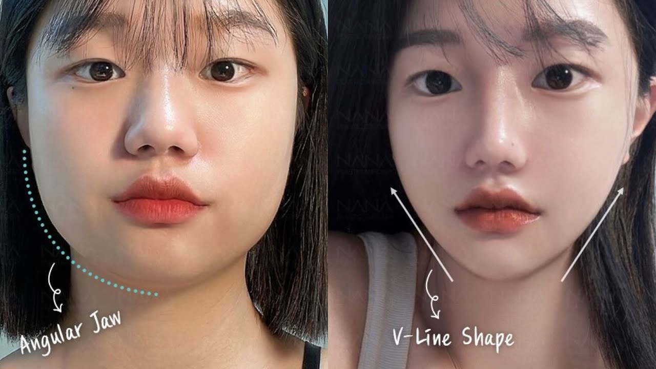 𝓷arrow V-shaped face 💉 [EXP] ୨ৎ