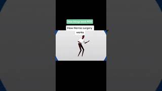 How  hernia surgery works #How things work #shorts