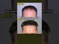 Is your hair looking thinner than you're used to?