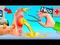 NICO, DIVENTA UN DOTTORE E CURA PIEDI!