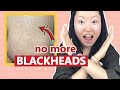 Low Irritation Blackhead Removal | How to effectively remove BLACKHEADS | Safe for Sensitive Skin