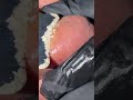 Blackhead Extraction That Feels Illegal