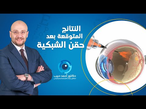 النتائج المتوقعة بعد حقن الشبكية دكتور أحمد حبيب