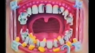 An Inside Job, 1987 Uncut version 4mations @acidonia150