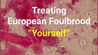 Treating EFB with Essential Oils