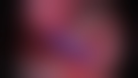 Right VATS En Bloc S3, S4, S5 Segmentectomy