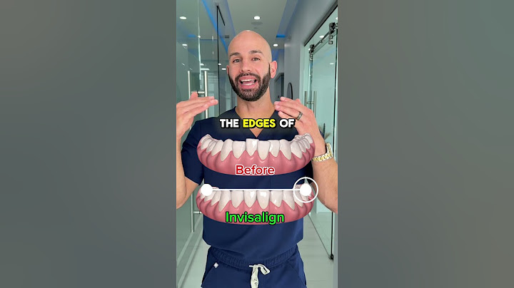 How to fix crooked lower teeth.