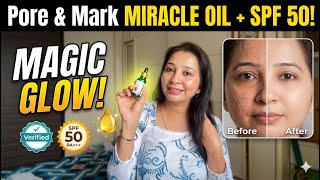 The Miracle Oil That Changed My Skin! Goodbye Marks & Pores Forever | vidhi chauhan