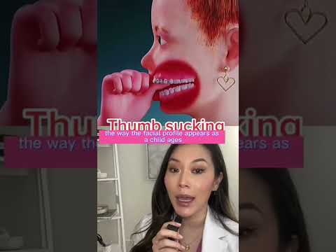What Does Thumb Sucking Do Long Term Thumbsucking Suckingypurthumb Dentist Cosmeticdentist 