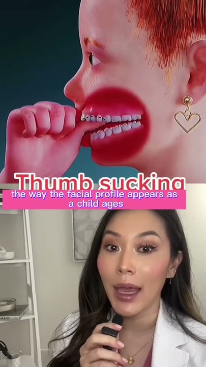 what-does-thumb-sucking-do-long-term-thumbsucking-suckingypurthumb