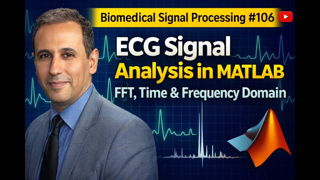 Biomedical Signal Processing #106 - ECG Signal Analysis in MATLAB | FFT ...