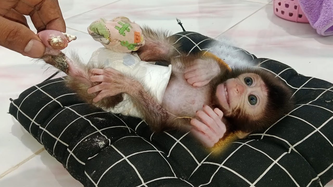 treating baby LiLi's swollen feet.. - YouTube