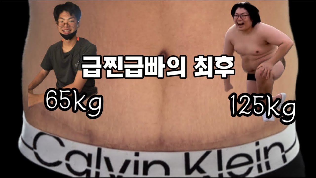 45일 동안 물만 먹고 40kg 뺐는데..복부거상술이 기다리고있었다..(극단적 다이어트 후기)