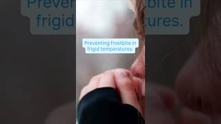 Celebrity 🥶Tips to prevent frostbite. Profile