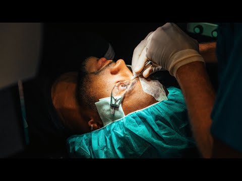 👁 GETTING LASIK (SURGICAL FOOTAGE) 👁