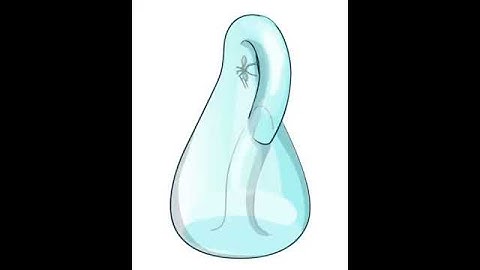 Animated topology: Ant walk on the Klein bottle