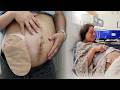 I Had a Baby with an Ostomy! | Stoma Management During Labor | Let's Talk IBD