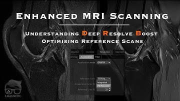 Enhanced MRI Scanning: Understanding Deep Resolve Boost and Optimizing Reference Scans